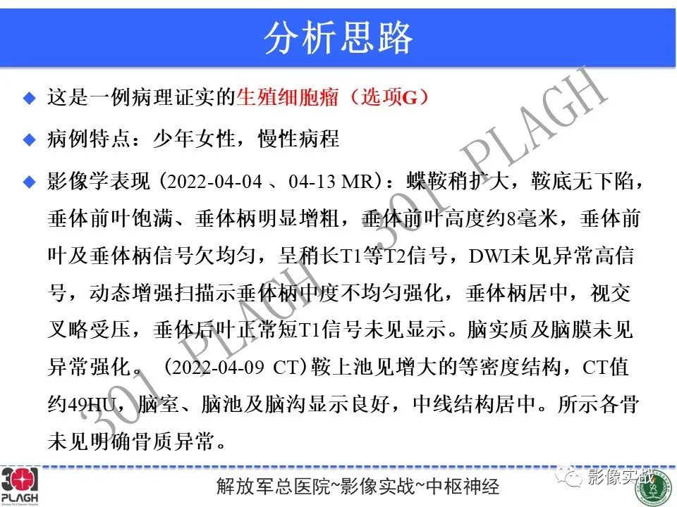 影像PPT - 【病例】鞍区生殖细胞瘤1例MR影像-25