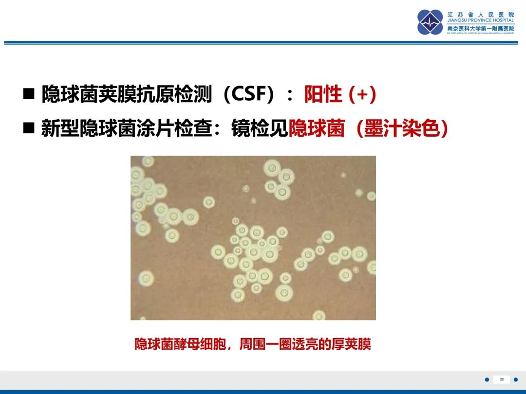 影像PPT - 【PPT】隐球菌脑膜脑炎-23