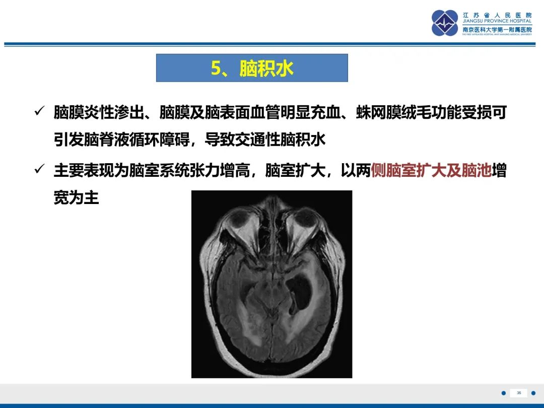 影像PPT - 【PPT】隐球菌脑膜脑炎-36