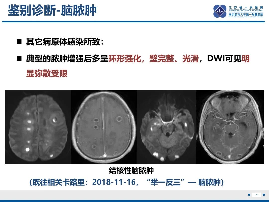影像PPT - 【PPT】隐球菌脑膜脑炎-42