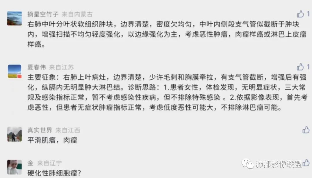 影像PPT - 【病例】罕见病理类型肺内肿瘤—绒毛膜癌1例-27 影像PPT - 【病例】罕见病理类型肺内肿瘤—绒毛膜癌1例-27