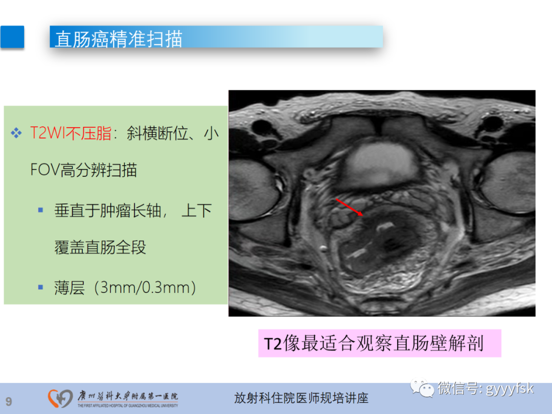 影像PPT - 【PPT】直肠癌MRI规范扫描及分期诊断-1