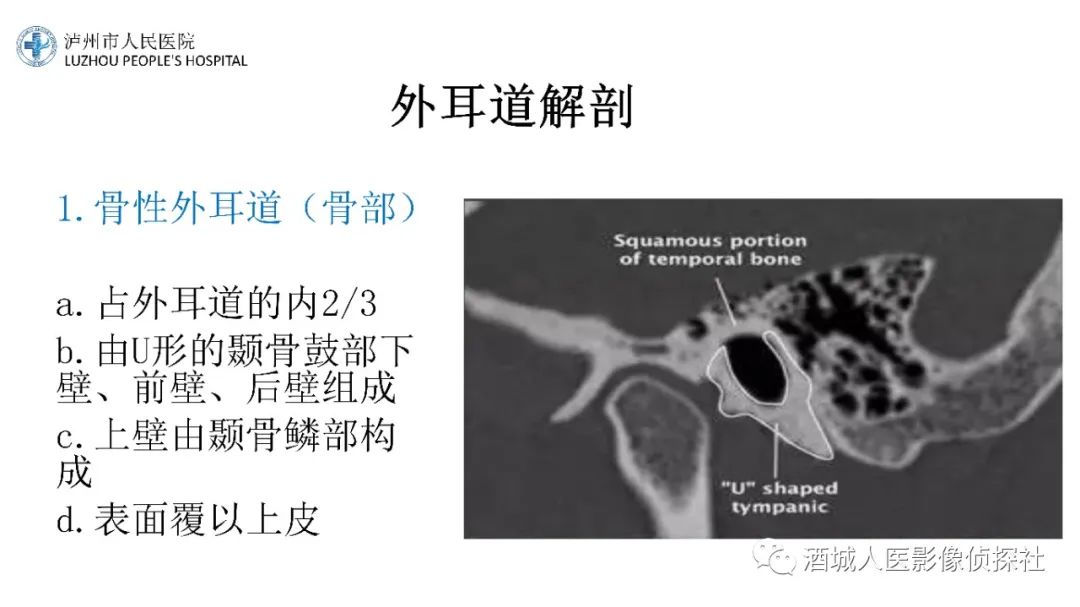 影像PPT - 【PPT】传导性耳聋的CT诊断-26