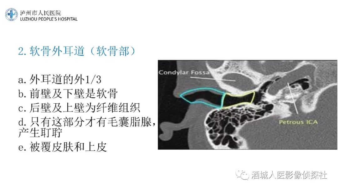 影像PPT - 【PPT】传导性耳聋的CT诊断-27