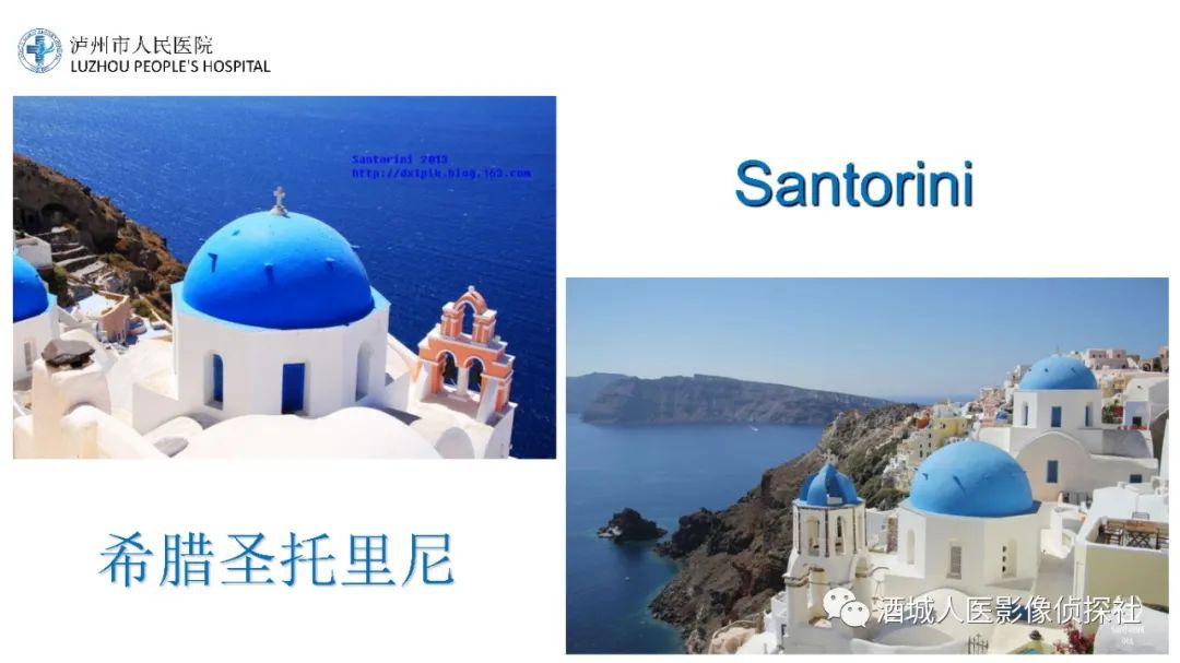 影像PPT - 【PPT】传导性耳聋的CT诊断-31