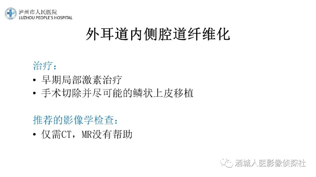影像PPT - 【PPT】传导性耳聋的CT诊断-52
