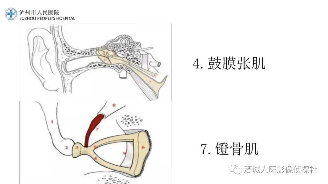 影像PPT - 【PPT】传导性耳聋的CT诊断-68
