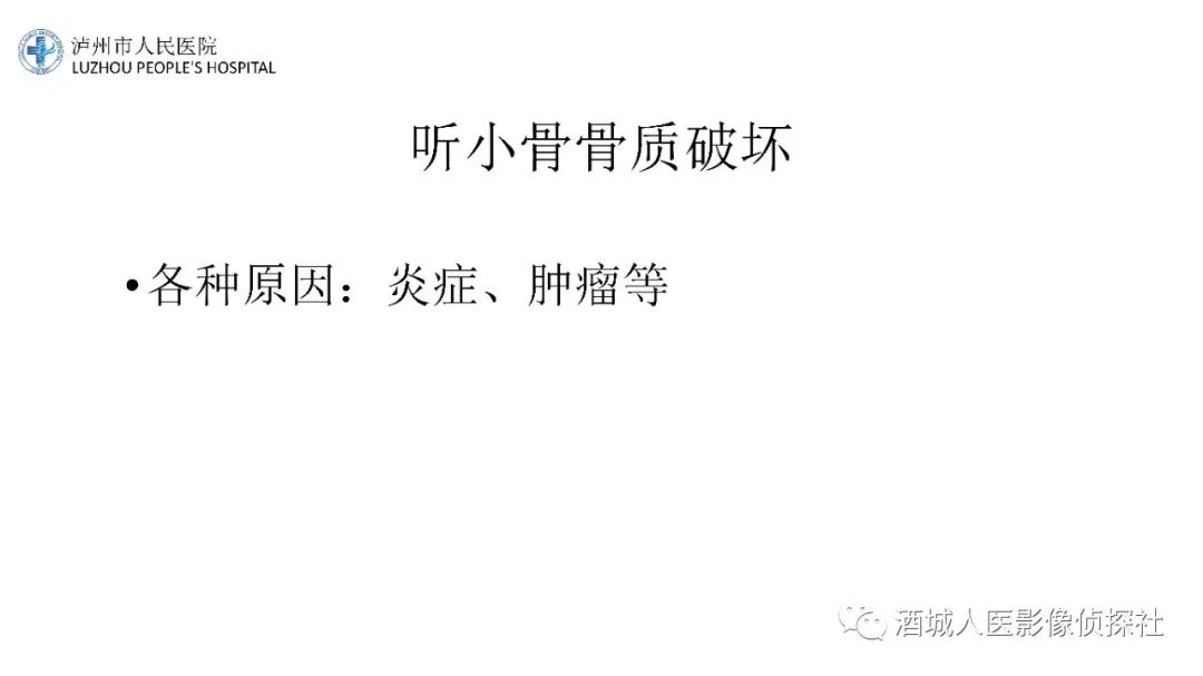 影像PPT - 【PPT】传导性耳聋的CT诊断-87