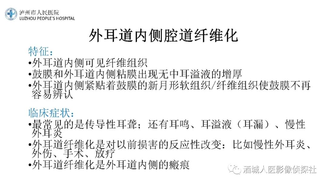 影像PPT - 【PPT】传导性耳聋的CT诊断-50