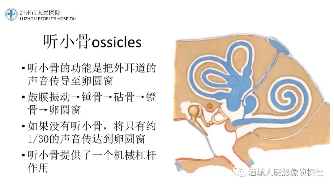 影像PPT - 【PPT】传导性耳聋的CT诊断-65