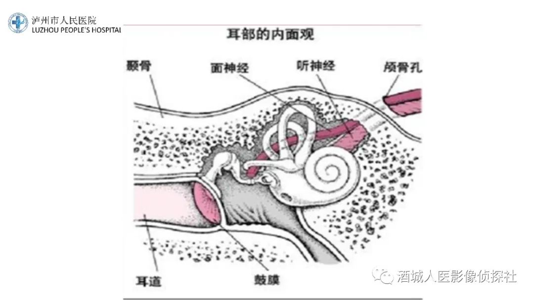 影像PPT - 【PPT】传导性耳聋的CT诊断-66