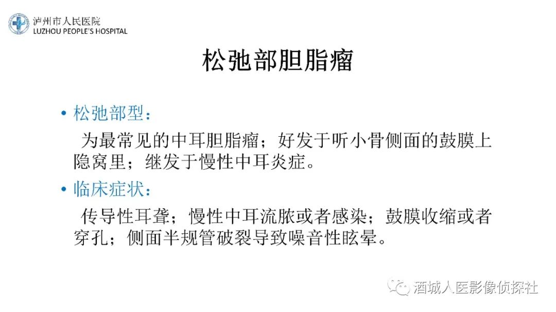 影像PPT - 【PPT】传导性耳聋的CT诊断-71