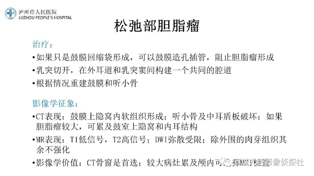 影像PPT - 【PPT】传导性耳聋的CT诊断-74