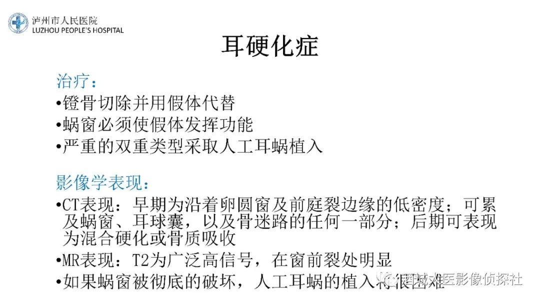 影像PPT - 【PPT】传导性耳聋的CT诊断-106
