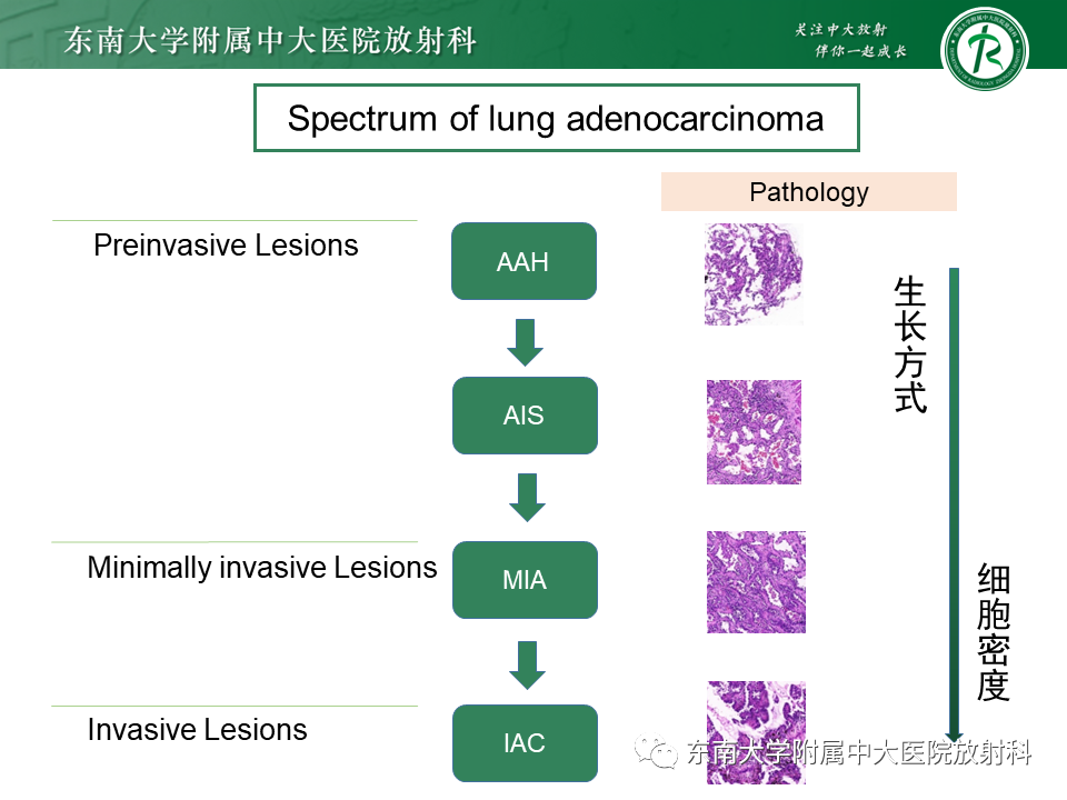 影像PPT - 【PPT】肺结节的鉴别诊断-7 影像PPT - 【PPT】肺结节的鉴别诊断-7