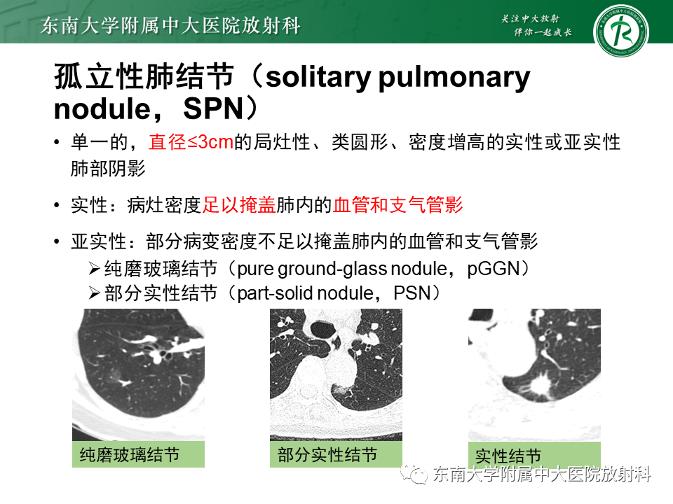 影像PPT - 【PPT】肺结节的鉴别诊断-6 影像PPT - 【PPT】肺结节的鉴别诊断-6