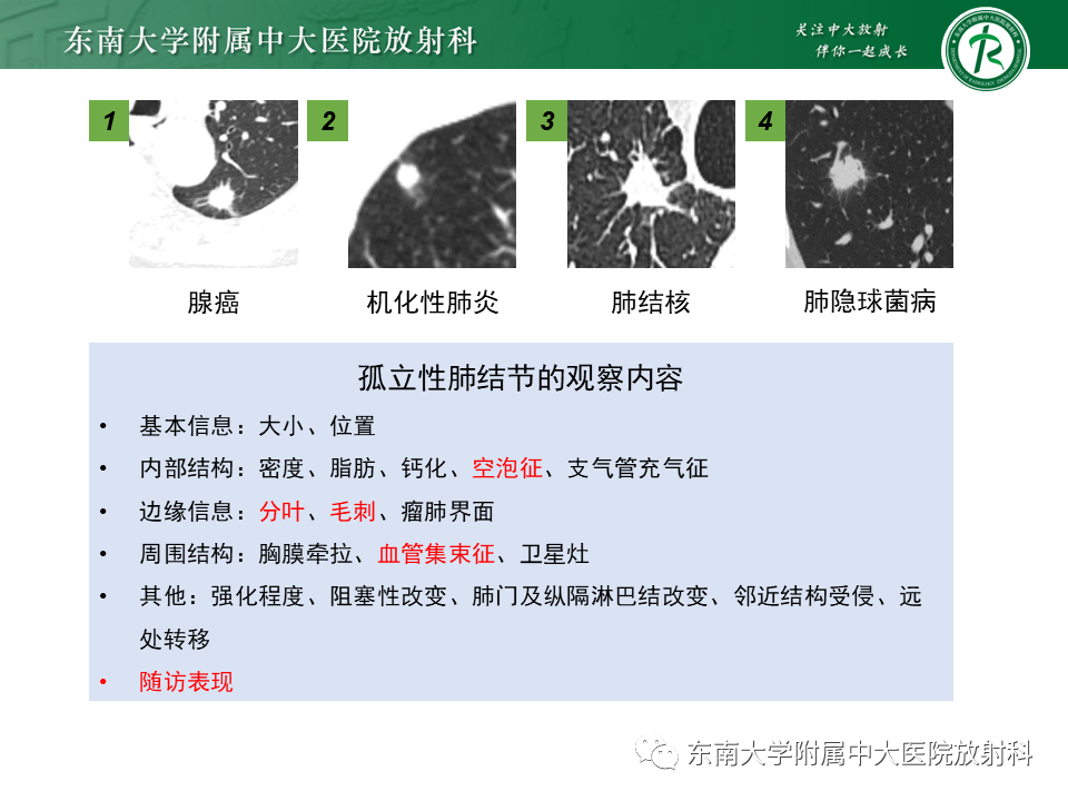 影像PPT - 【PPT】肺结节的鉴别诊断-15 影像PPT - 【PPT】肺结节的鉴别诊断-15