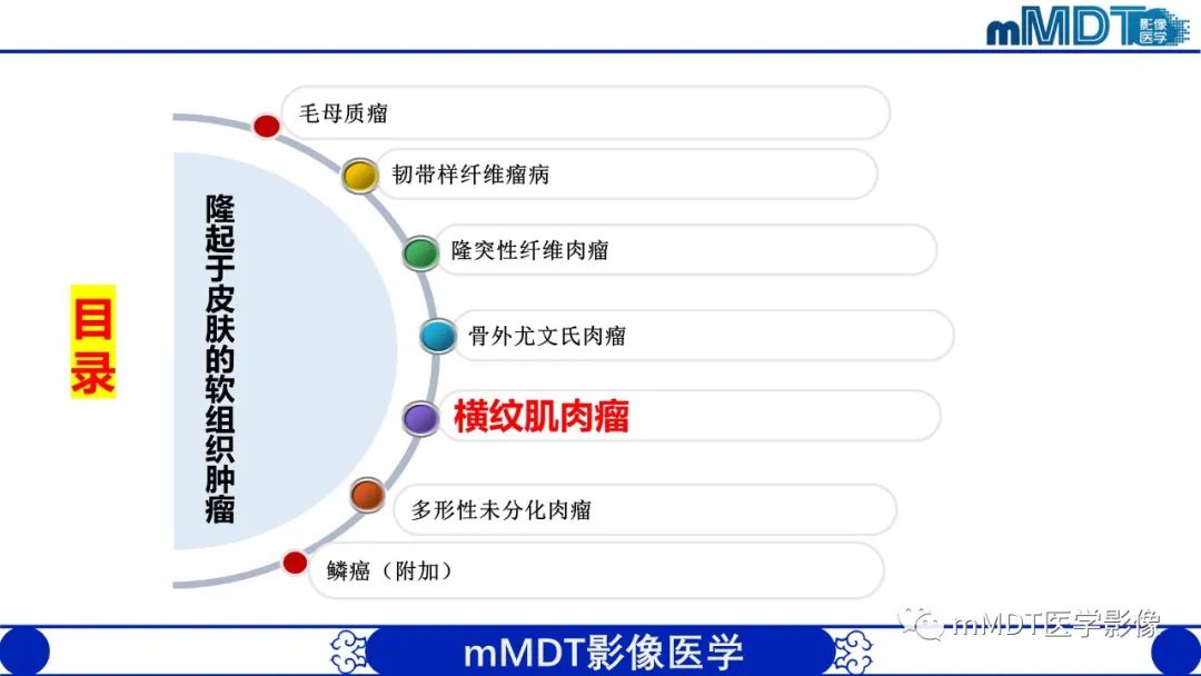 影像PPT - 【PPT】隆起于皮肤的肿瘤探讨-30