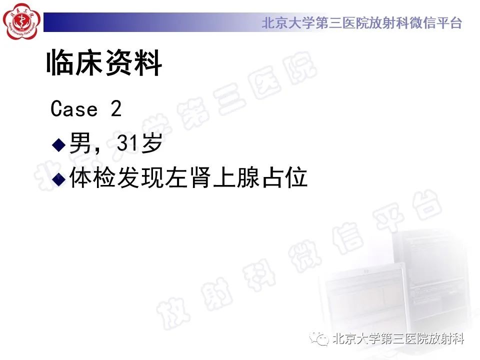 影像PPT - 【PPT】肾上腺节细胞神经瘤-12
