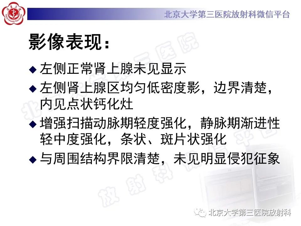 影像PPT - 【PPT】肾上腺节细胞神经瘤-10
