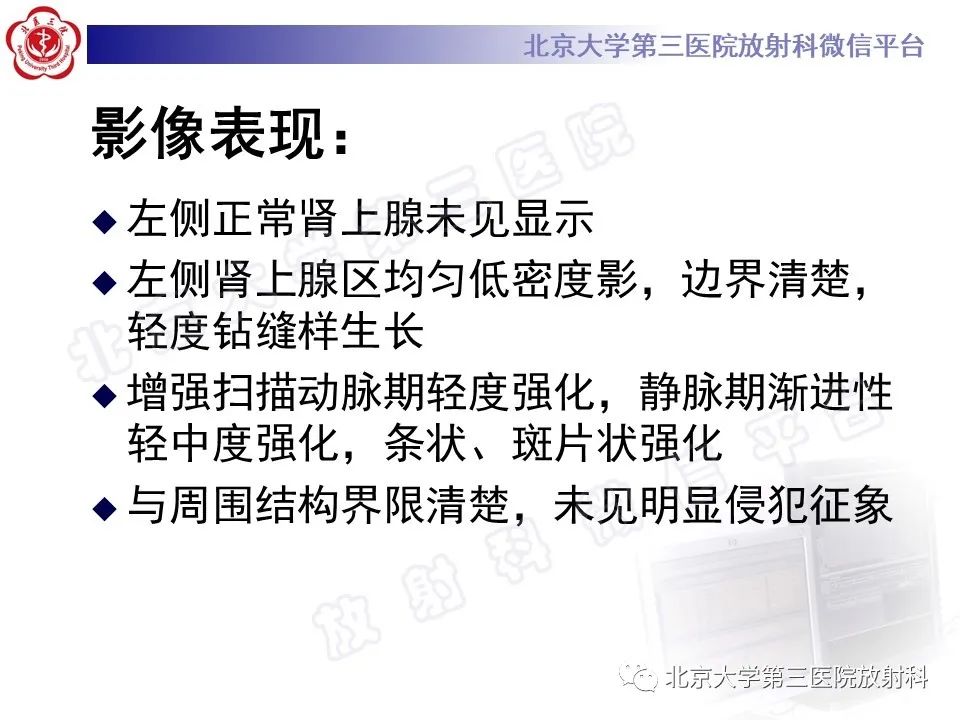 影像PPT - 【PPT】肾上腺节细胞神经瘤-20