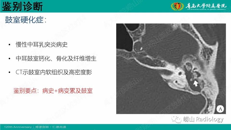 影像PPT - 【病例】耳硬化症1例CT影像-22