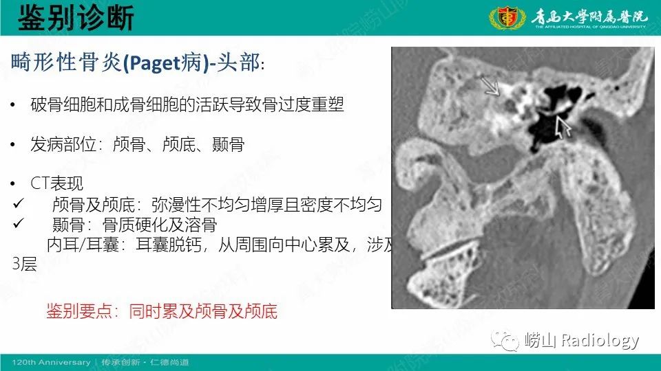影像PPT - 【病例】耳硬化症1例CT影像-24