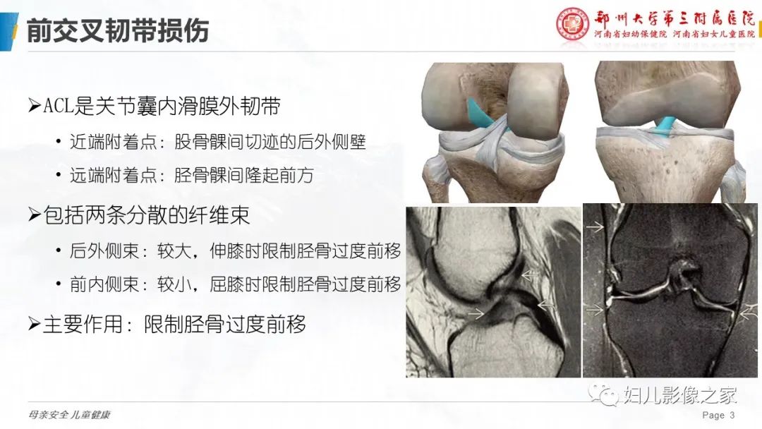 影像PPT - 【PPT】膝关节韧带病变的影像学表现-3