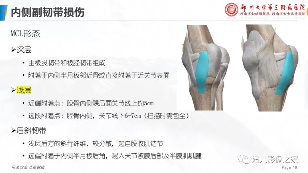 影像PPT - 【PPT】膝关节韧带病变的影像学表现-18
