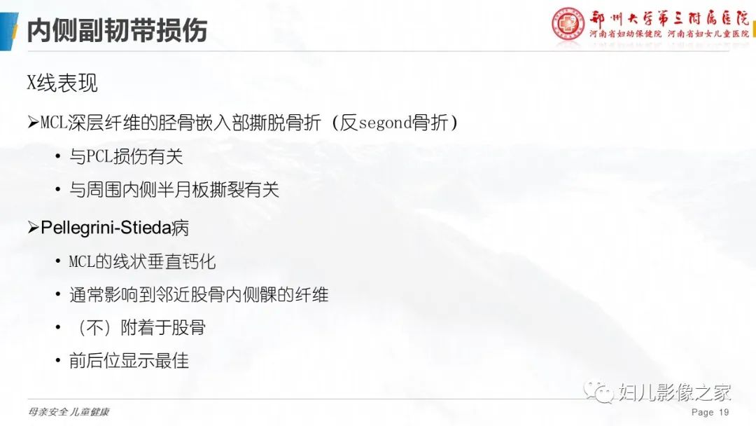 影像PPT - 【PPT】膝关节韧带病变的影像学表现-19