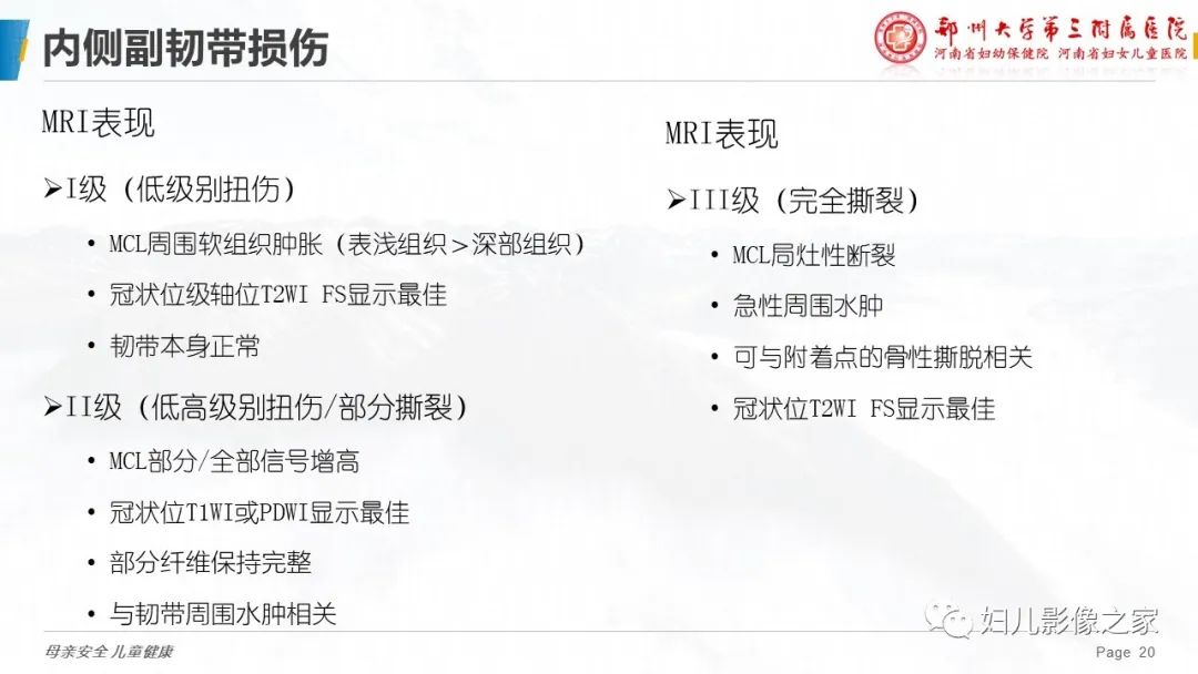 影像PPT - 【PPT】膝关节韧带病变的影像学表现-20