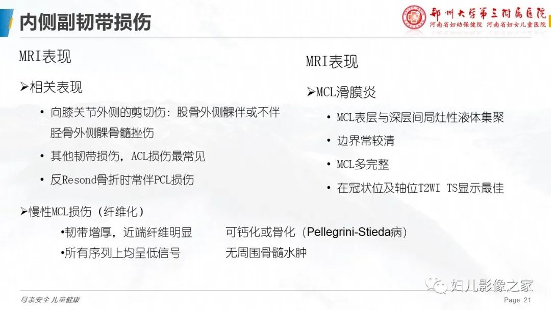 影像PPT - 【PPT】膝关节韧带病变的影像学表现-21