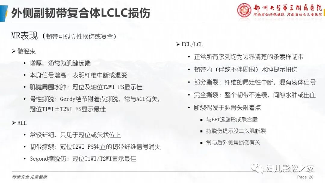 影像PPT - 【PPT】膝关节韧带病变的影像学表现-28