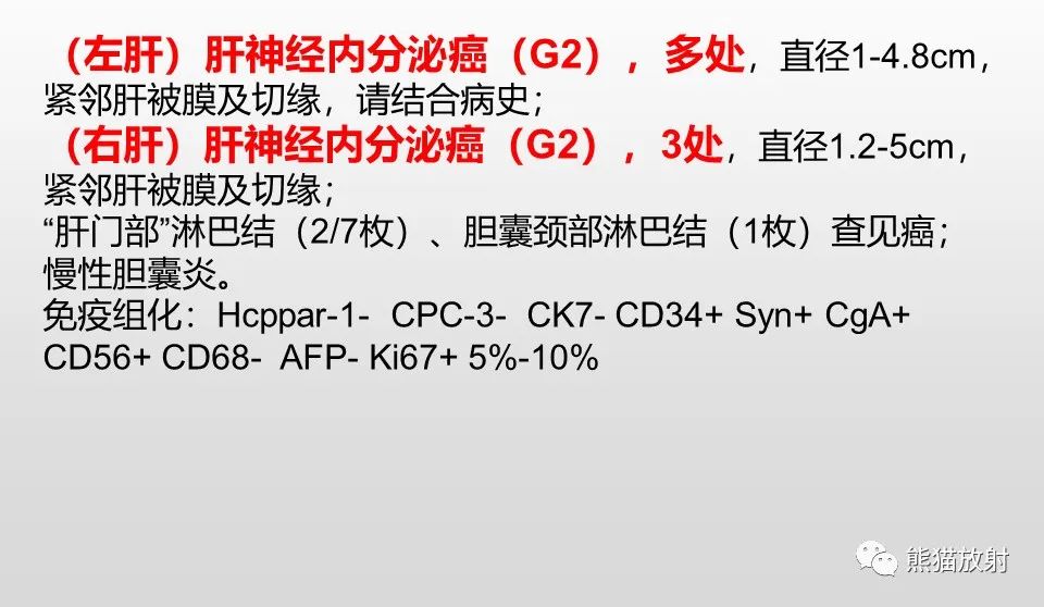 影像PPT - 【病例】肝脏多发神经内分泌癌1例MR及CT-13