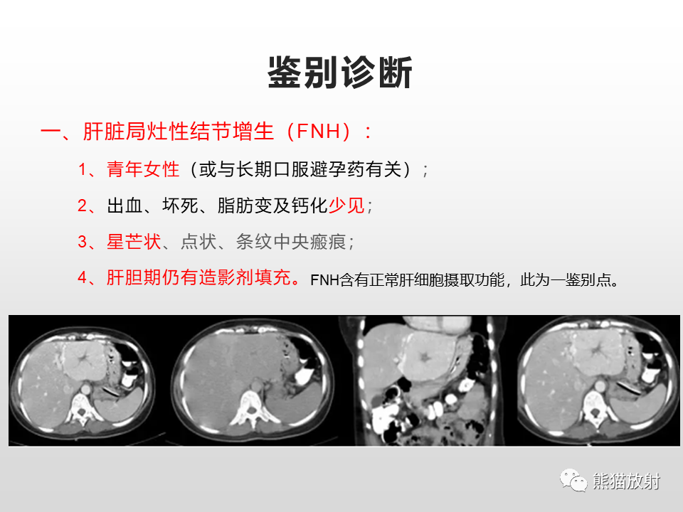 影像PPT - 【病例】肝脏多发神经内分泌癌1例MR及CT-22