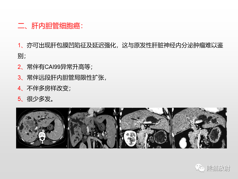 影像PPT - 【病例】肝脏多发神经内分泌癌1例MR及CT-23