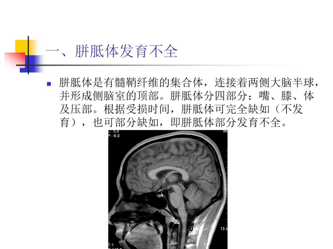 影像PPT - 【PPT】先天畸形、变性及椎管疾病-4