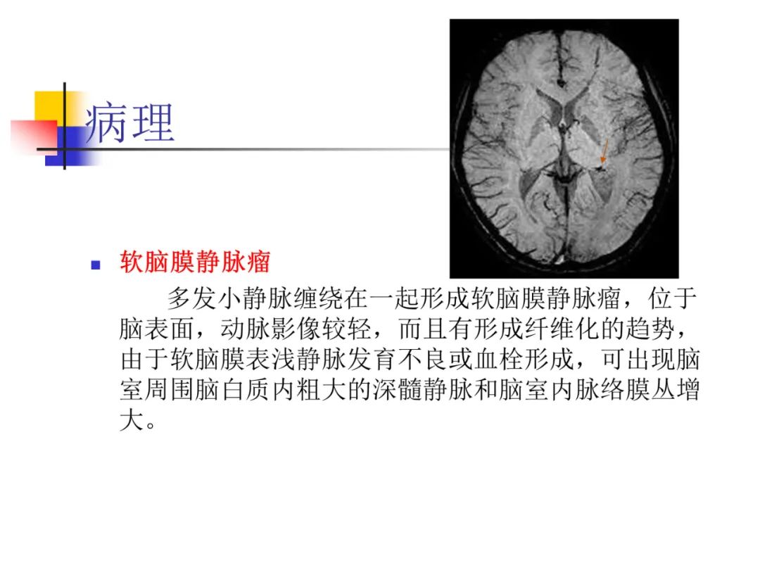影像PPT - 【PPT】先天畸形、变性及椎管疾病-39