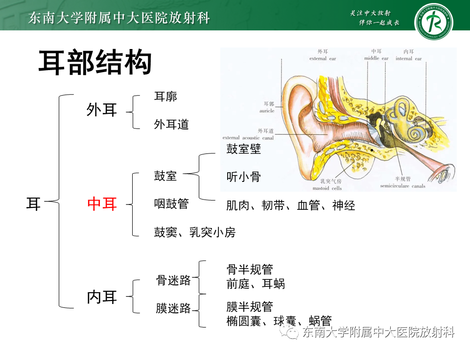影像PPT - 【PPT】中耳胆脂瘤-5 影像PPT - 【PPT】中耳胆脂瘤-5