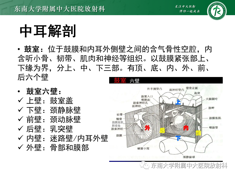 影像PPT - 【PPT】中耳胆脂瘤-6 影像PPT - 【PPT】中耳胆脂瘤-6