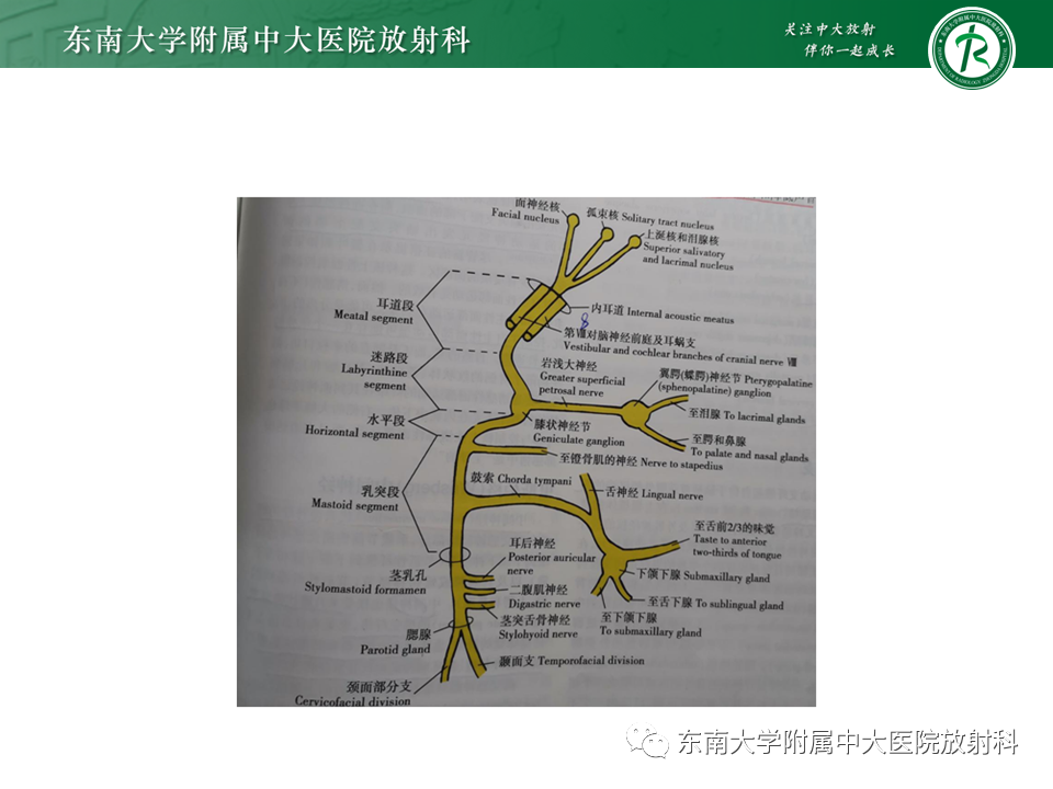 影像PPT - 【PPT】中耳胆脂瘤-7 影像PPT - 【PPT】中耳胆脂瘤-7