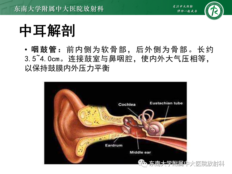 影像PPT - 【PPT】中耳胆脂瘤-8 影像PPT - 【PPT】中耳胆脂瘤-8