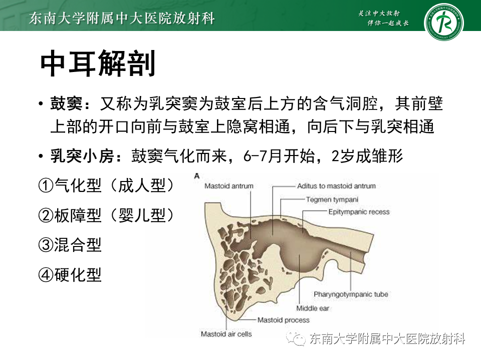 影像PPT - 【PPT】中耳胆脂瘤-9 影像PPT - 【PPT】中耳胆脂瘤-9