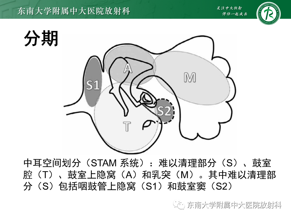 影像PPT - 【PPT】中耳胆脂瘤-13 影像PPT - 【PPT】中耳胆脂瘤-13