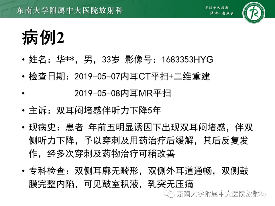影像PPT - 【PPT】中耳胆脂瘤-23 影像PPT - 【PPT】中耳胆脂瘤-23