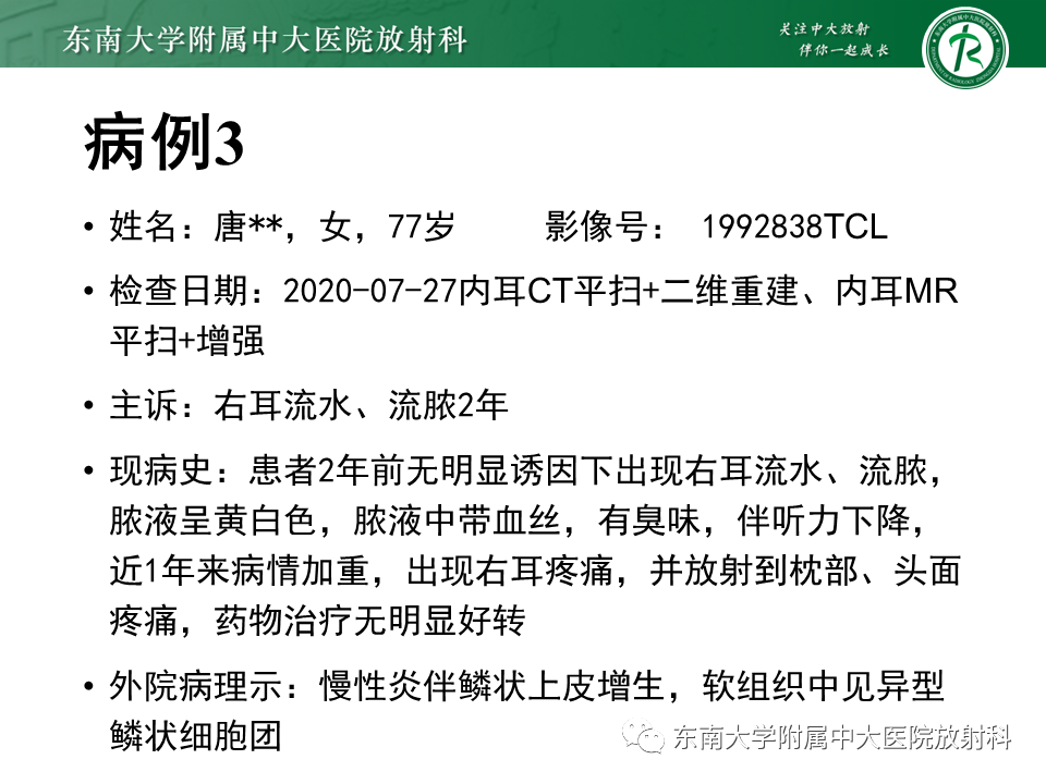 影像PPT - 【PPT】中耳胆脂瘤-34 影像PPT - 【PPT】中耳胆脂瘤-34