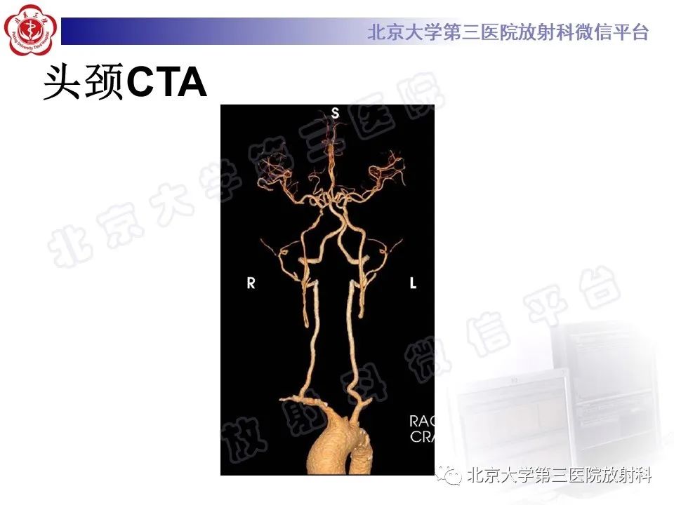 影像PPT - 【PPT】大动脉炎-5