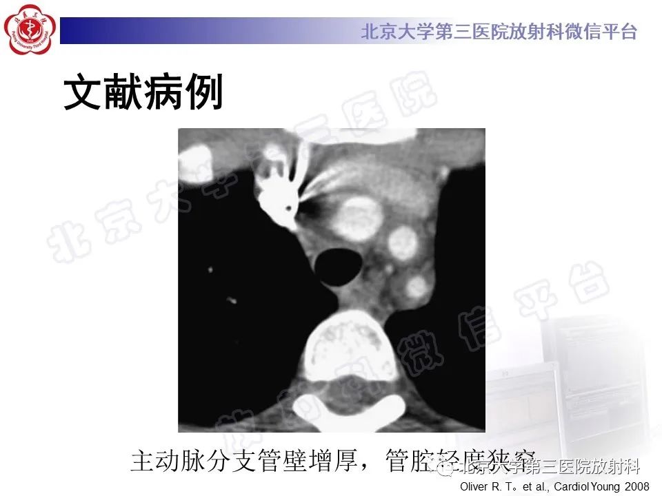 影像PPT - 【PPT】大动脉炎-22