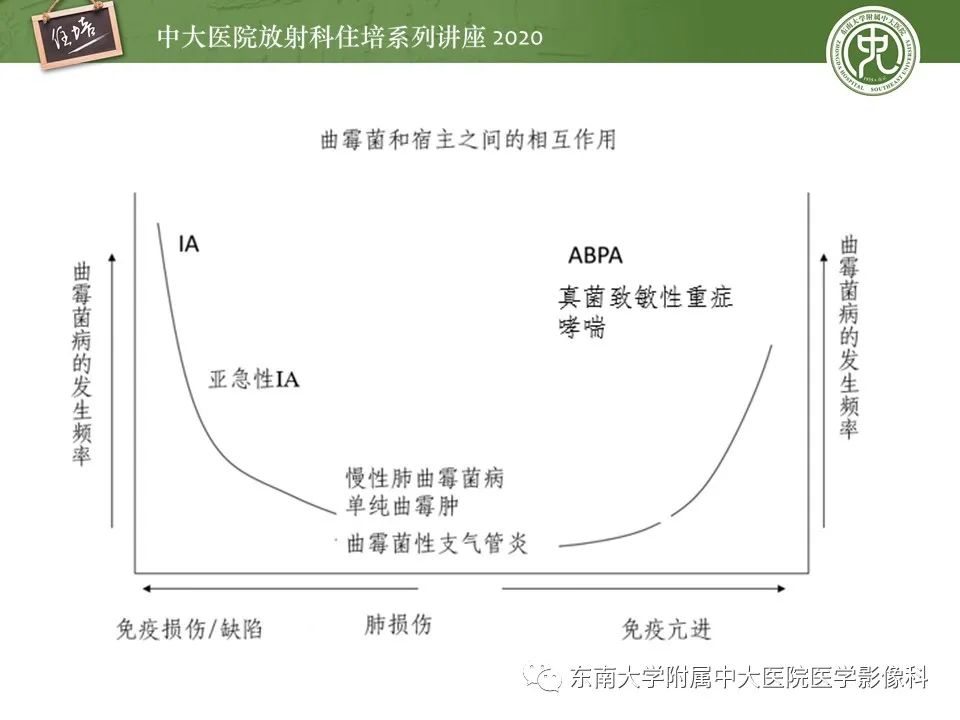 影像PPT - 【PPT】肺真菌病的影像诊断-12