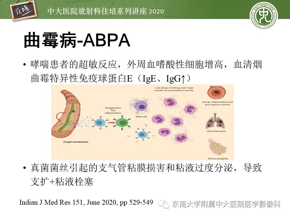 影像PPT - 【PPT】肺真菌病的影像诊断-18